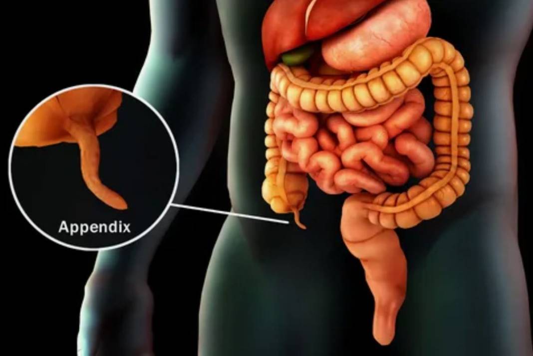 Apandisit nedir? Apandisit gereksiz bir organ mı? 14